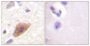 Tyrosine Hydroxylase antibody