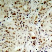 Rb (phospho Ser807) Antibody