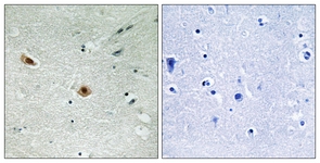 Retinoblastoma (Phospho-Ser608) antibody