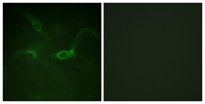 FGFR1 (Phospho-Tyr654) antibody