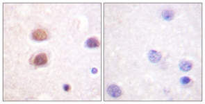 p38 MAPK (Phospho-Tyr322) antibody