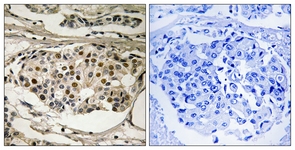 NF-kappaB p65 (Phospho-Ser281) antibody