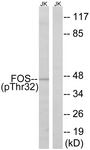 FOS (Phospho-Ser32) antibody