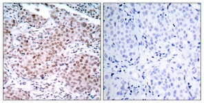 Estrogen Receptor-alpha (Phospho-Ser104) antibody