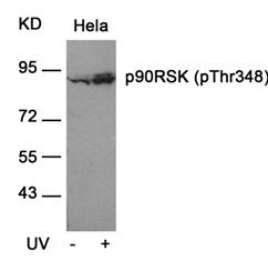 p90RSK (phospho Thr348) Antibody