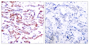 ATF2 (Phospho-Thr71 or 53) antibody