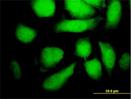 MAP2K5 Antibody (monoclonal) (M11)