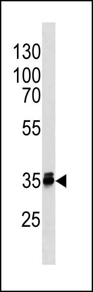 MBD3 Antibody (C-term)
