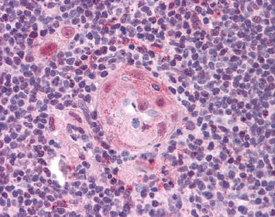 TLR2 antibody - C-terminal region