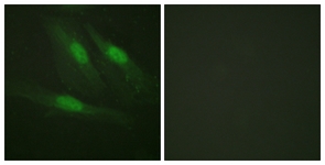 Catenin-beta antibody
