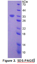 Recombinant Estrogen Receptor Alpha (ERa)