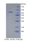 Recombinant Wingless Type MMTV Integration Site Family, Member 10B (WNT10B)