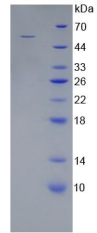 Recombinant Wingless Type MMTV Integration Site Family,Member 10A (WNT10A)