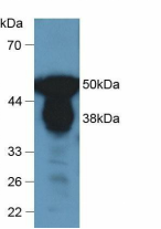 Polyclonal Antibody to Pepsin (PP)