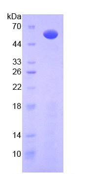 Mouse  Recombinant Interleukin 10 Receptor Alpha (IL10Ra)