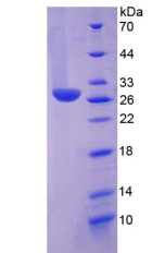 Recombinant Human Histidine Decarboxylase (HDC)