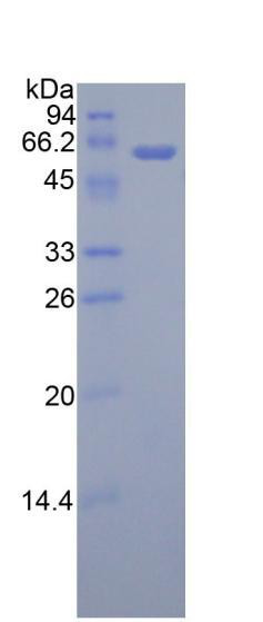 Human  Active Adiponectin Receptor 1 (ADIPOR1)