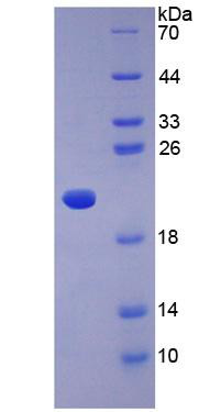 Human  Recombinant Adiponectin (ADP)