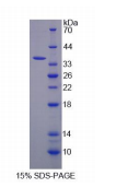 Recombinant Kelch Like ECH Associated Protein 1 (KEAP1)