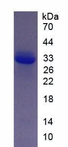 Recombinant Collagen Type XI Alpha 1 (COL11a1)