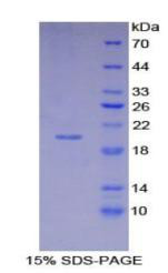 Recombinant Human Cyclin Dependent Kinase Inhibitor 2A (CDKN2A)